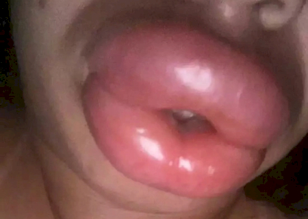 Falsa biomédica que deformou boca de pacientes é indiciada por quatro crimes