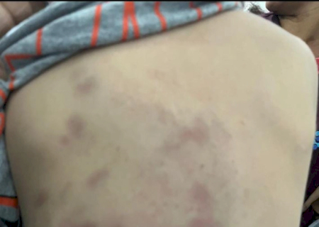 Mãe sai para trabalhar e filho de 3 anos é espancado pelo padrasto; autor está preso