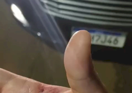 Corrida em carro de aplicativo acaba com motorista mordido pela passageira (Video)