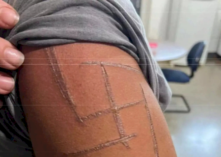 Justiça decreta prisão preventiva de trio acusado de marcar mulher trans com suástica